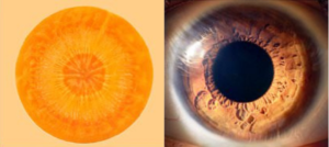 Foods That mimic the organ that aid Eyes